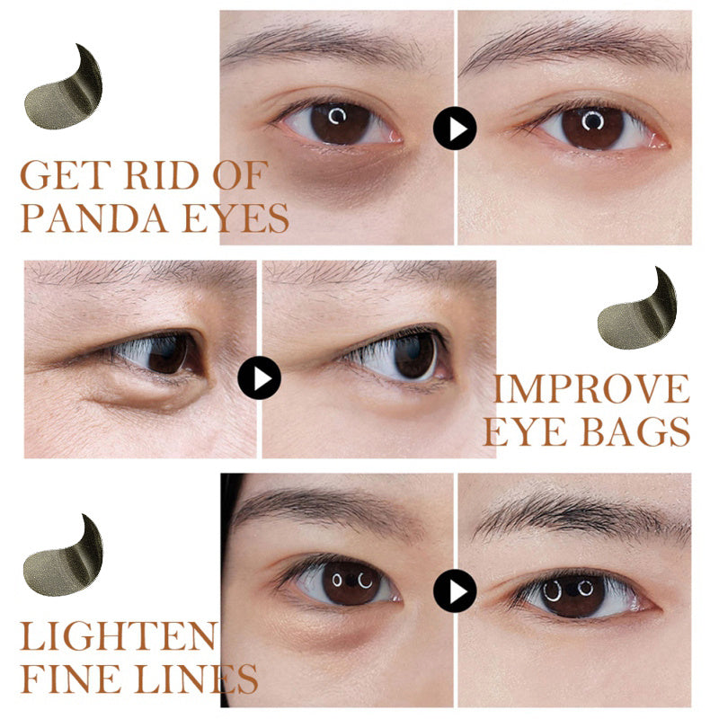 Fade Fine Lines And Dark Circles Under Eye Bags Moisturizing Black Pearl  Mask
